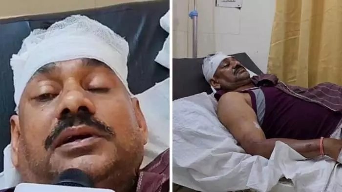 आरोपी पकड़ने गई छत्तीसगढ़ पुलिस पर हमला, ‘चोर-चोर’ की अफवाह फैलते ही ग्रामीणों ने घेरा, एक जवान गंभीर घायल