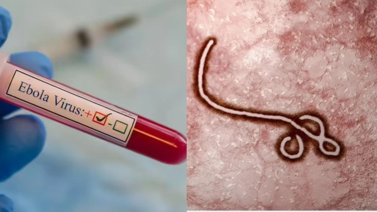 CG Health Alert: दुर्ग में इबोला के 3 संदिग्ध, प्रशासन ने बढ़ाई निगरानी, स्वास्थ्य विभाग अलर्ट मोड पर